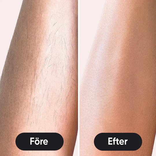 LumeaTouch | IPL – Dauerhafte Haarentfernung Decorique.de