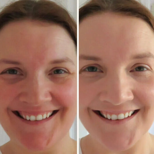 MushLux | Hudforbedrende Svampefoundation Decorique.de