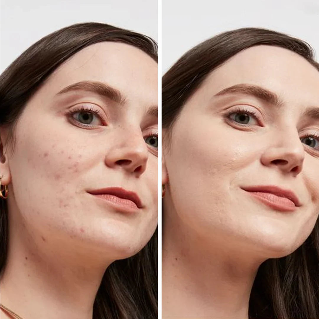 MushLux | Hudforbedrende Svampefoundation Decorique.de