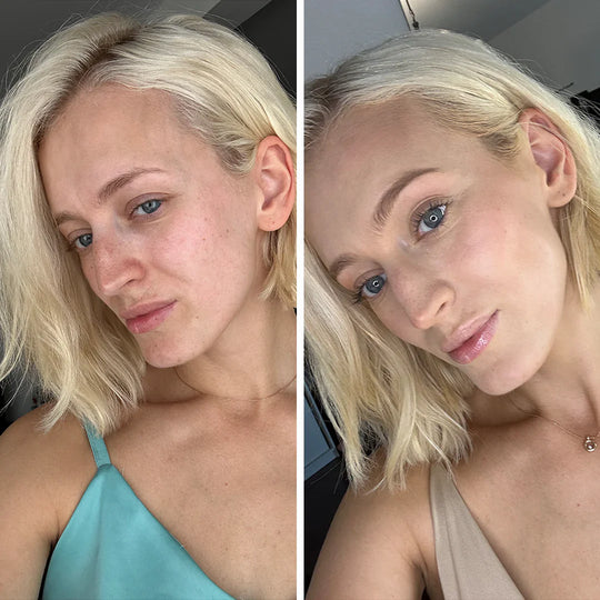 MushLux | Hudforbedrende Svampefoundation Decorique.de