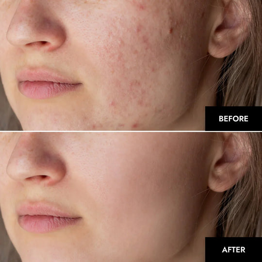 NanoBloom | Kollagen Augenmaske Decorique.de