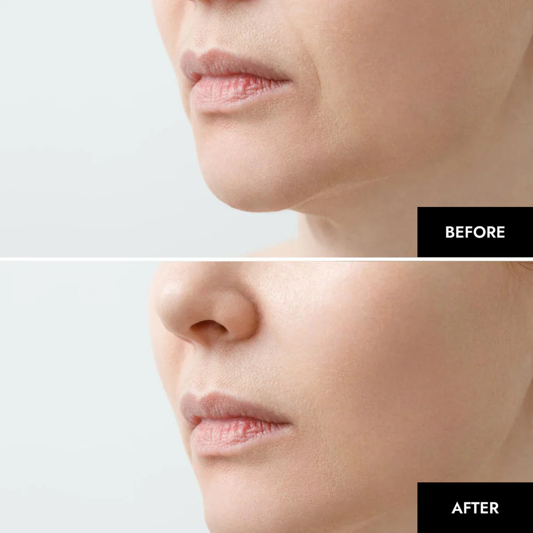 NanoBloom | Kollagen Augenmaske Decorique.de