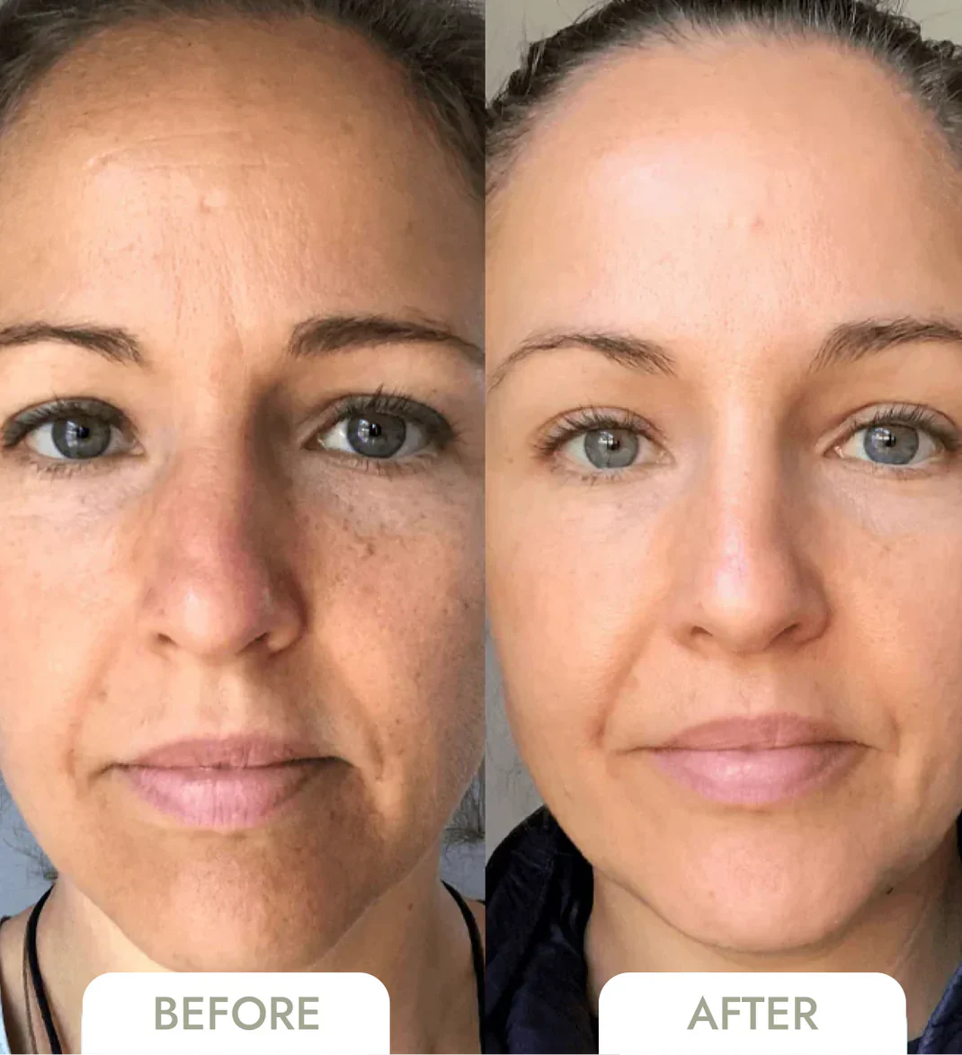 NanoBloom | Kollagen Augenmaske Decorique.de