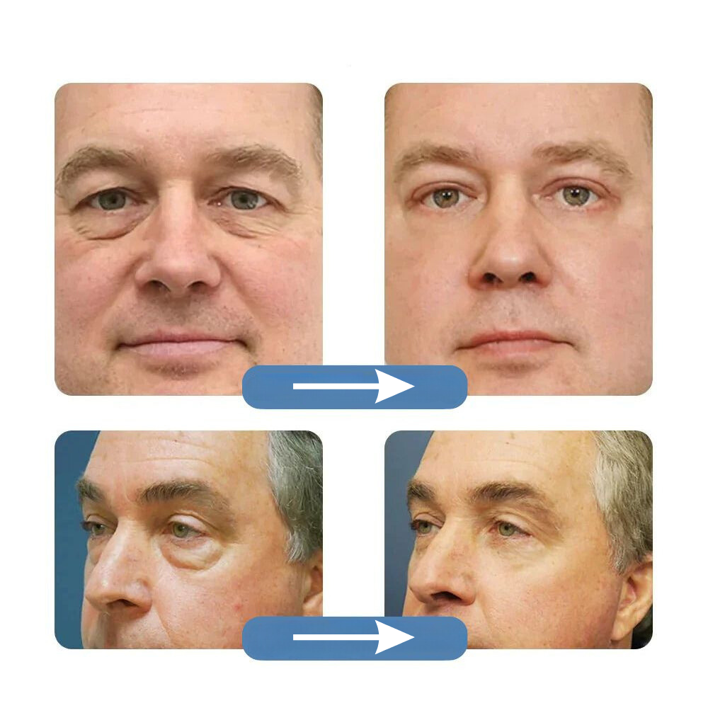 OpenEyes | Belebende Wärme-Kälte-Augenpflege Decorique.de