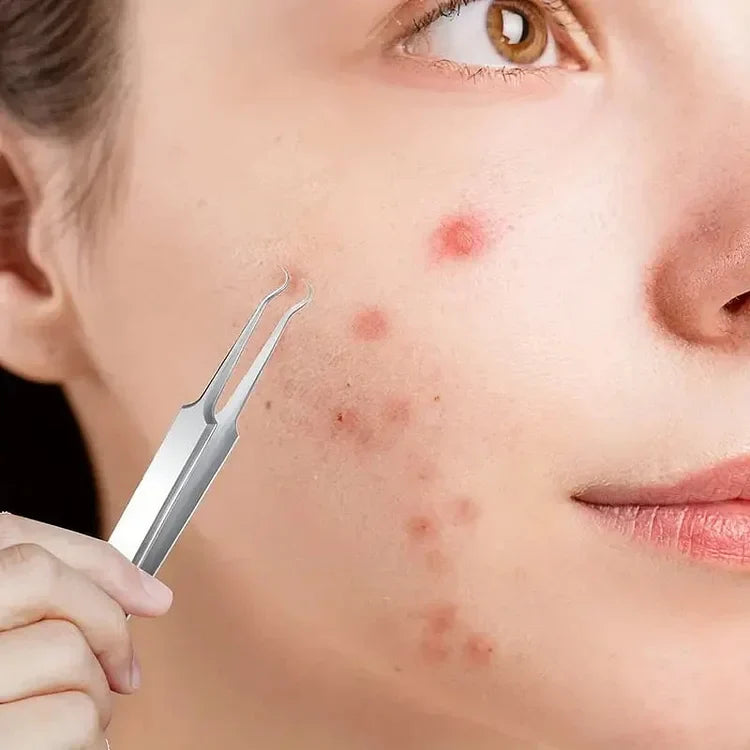 PoreSharp | Präzise Pinzetten für Mitesser & Whiteheads Decorique.de