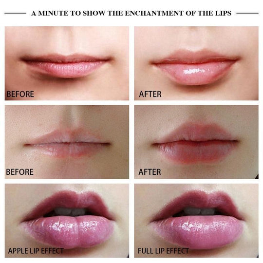 GlowPout | Elektrisches automatisches Lippenvergrößerungsgerät