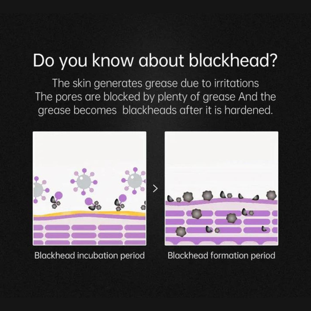 PurePore | Profi-Mitesserentferner für Klare Haut Decorique.de