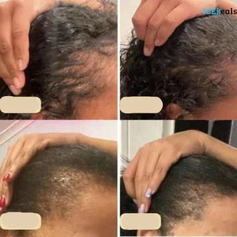 PureRoot | Veganes Pflegeöl für gesundes Haarwachstum Decorique.de