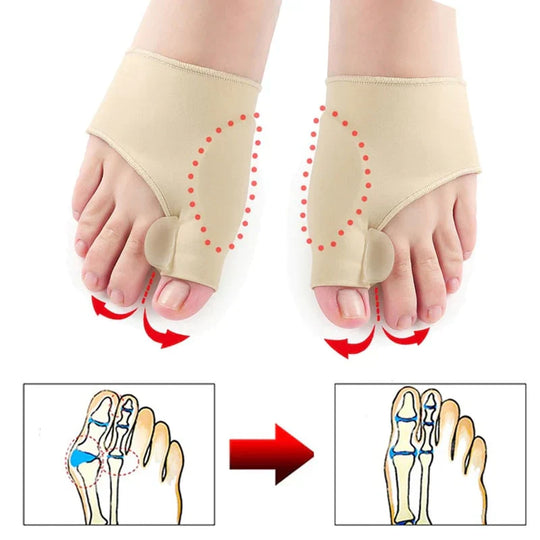 OrthoFit | Schmerzfreier Hallux-Valgus-Korrektor (2 Stück)