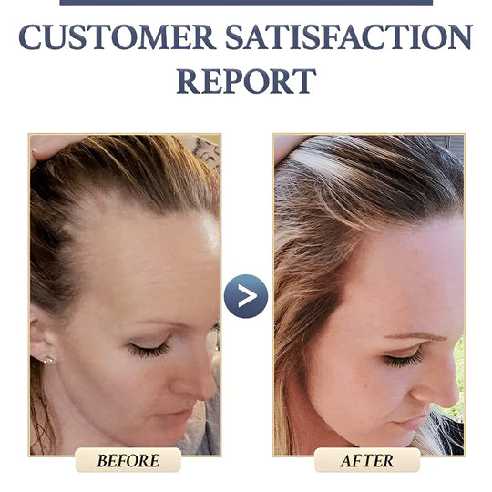 SilkRoot | Haarseife – Für Dichteres & Gesünderes Haar Decorique.de