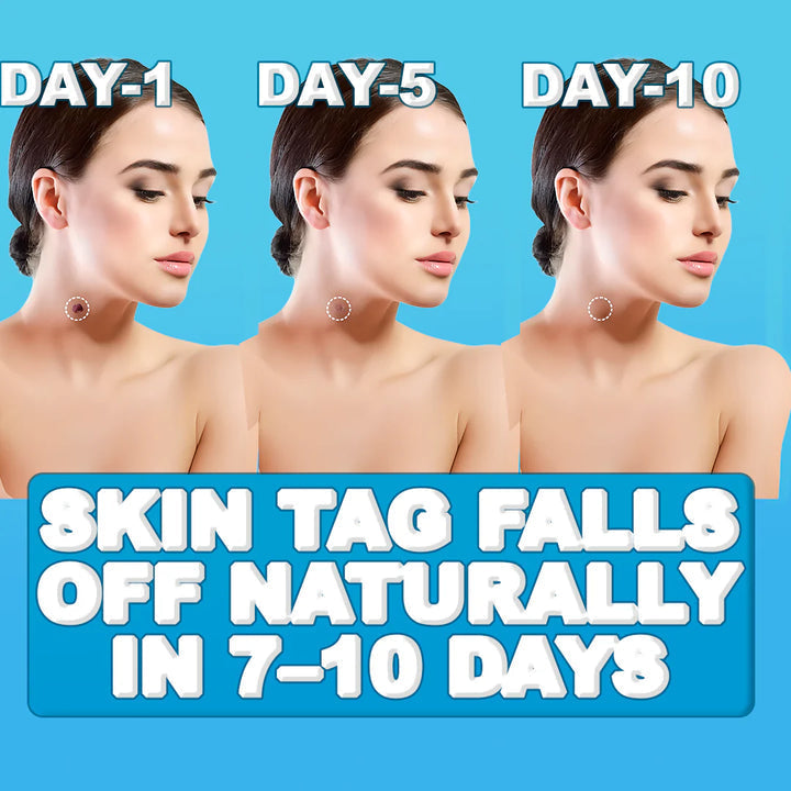 SilkSkin | Schmerzfreier Hautanhänger-Entferner Decorique.de