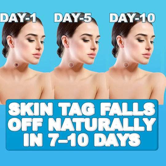 SilkSkin | Schmerzfreier Hautanhänger-Entferner Decorique.de