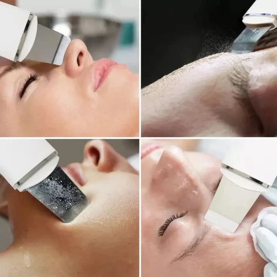 SkinNova | Exfoliating Skin Scrubber für strahlende Haut Decorique.de