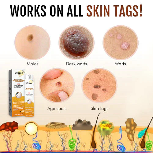 SkinPure | Warzen- & Hauttagspray – Schnell wirkend, Präzisionsdüse Decorique.de