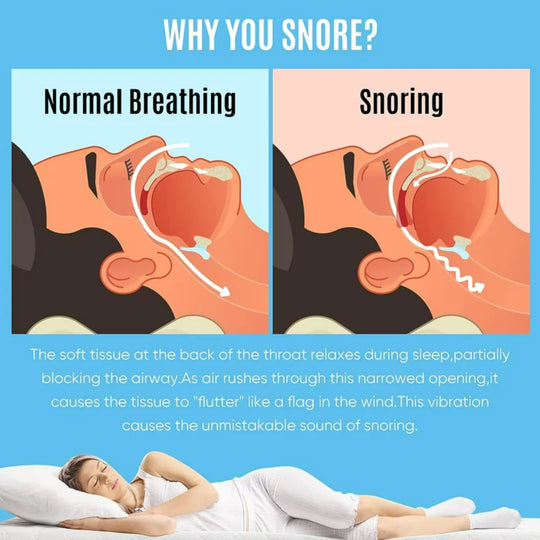 SleepPure | Anti-Schnarch-Schiene gegen Schlafapnoe Decorique.de