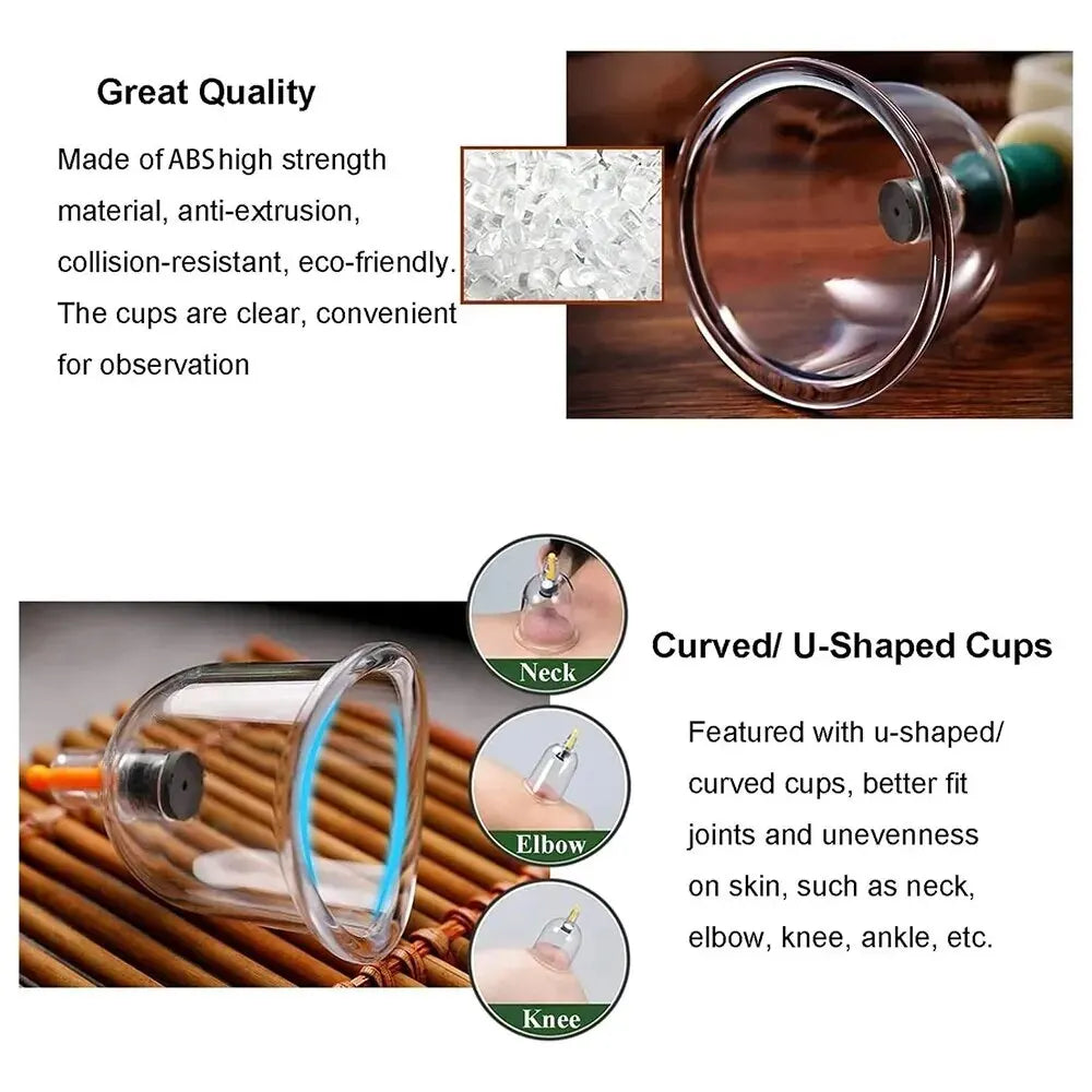 TheraCupping | Schröpfset – 32 Vakuum-Schröpfgläser Decorique.de