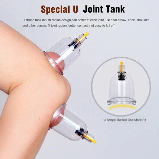 TheraCupping | Schröpfset – 32 Vakuum-Schröpfgläser Decorique.de