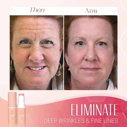 WrinkleEase | Feuchtigkeitspflege mit Soforteffekt Decorique.de