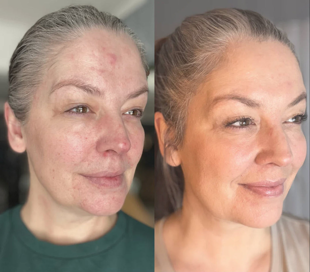 YouthRay | LED Lichttherapie Maske Decorique.de