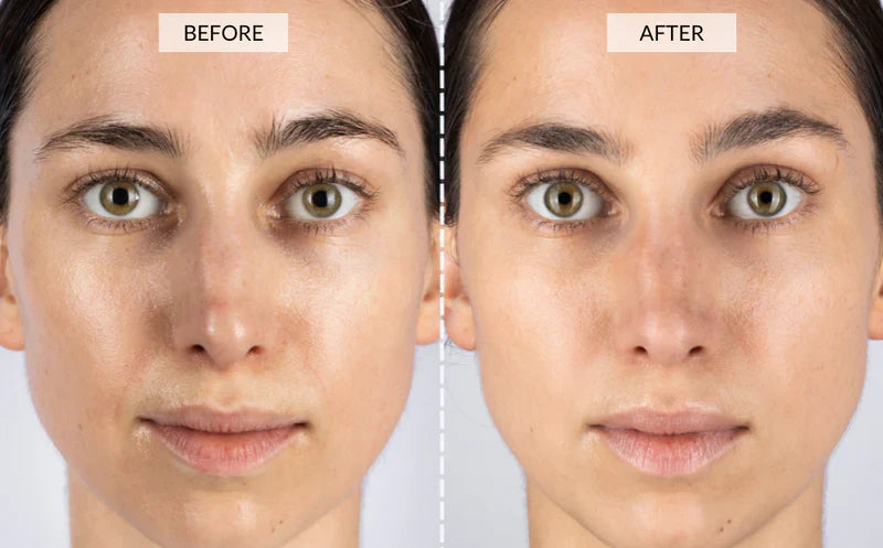 YouthRay | LED Lichttherapie Maske Decorique.de