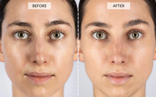 YouthRay | LED Lichttherapie Maske Decorique.de