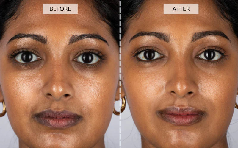 YouthRay | LED Lichttherapie Maske Decorique.de